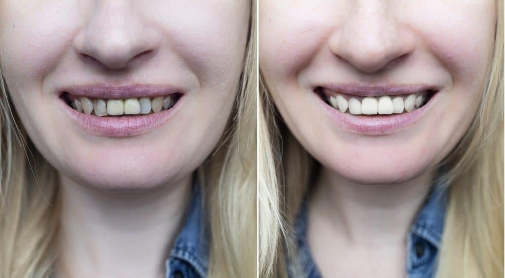 After Dental Cases