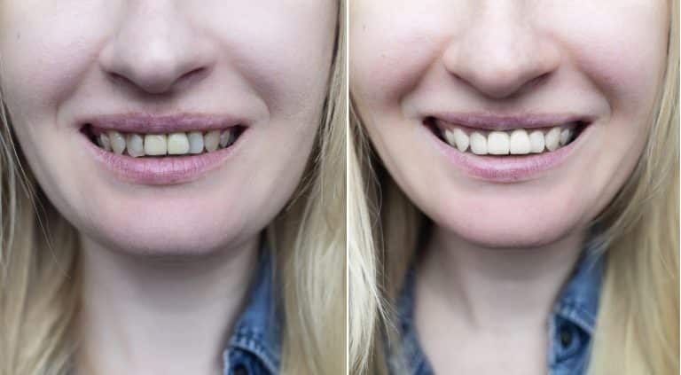How Visual Before-and-After Dental Cases Empower Patient Decision-Making