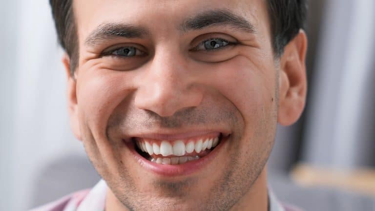 How to Use Before-and-After Smile Cases to Find a Trusted Dentist