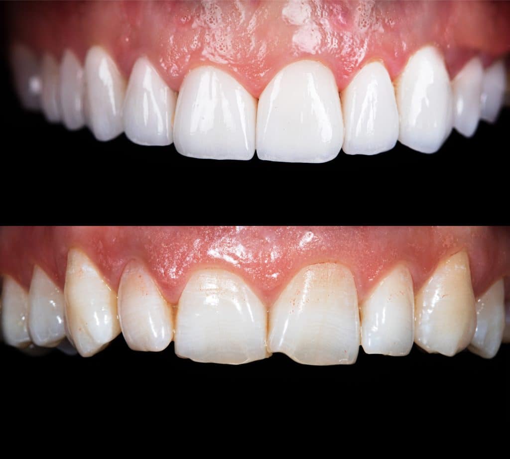Dental Cases
