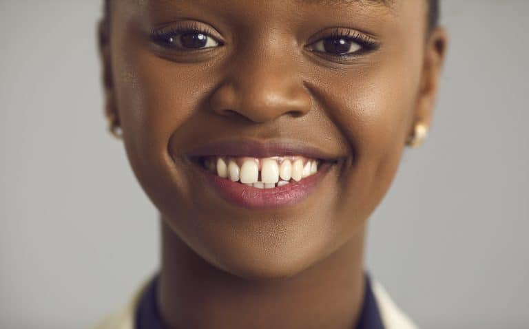 How to Choose a Dentist Using Verified Before-and-After Smile Cases