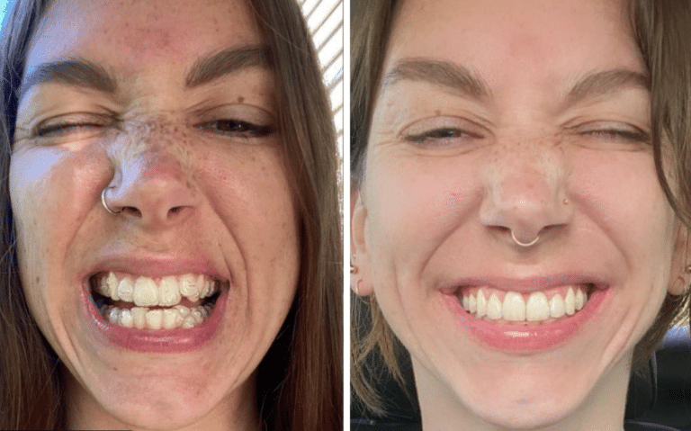 How to Compare Dental Before-and-After Photos Before You Choose a Dentist