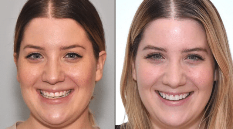 How to Choose the Right Cosmetic Dental Treatment Using Real Before-and-After Cases